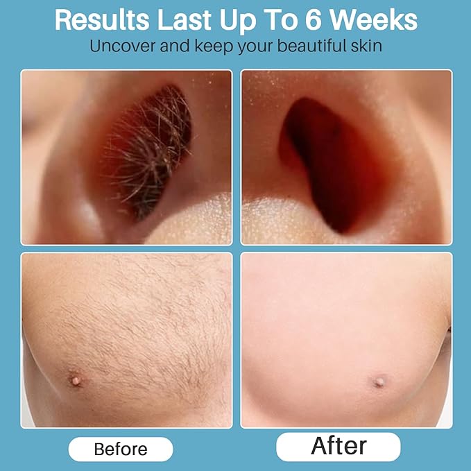 BLITZWAX Back and Nose Waxing Kit for Men, Hard Wax Warmer for Brazilian, Body and Face, At Home Hair Removal Kit, Beginner Friendly, Quick Heating, 93 Accessories, Royal Blue