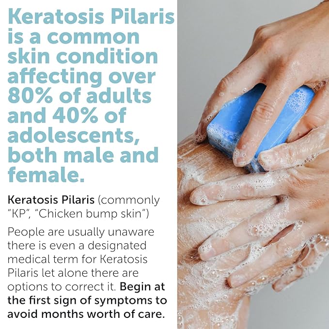 Body Soap for Keratosis Pilaris | Exfoliating Soap Scrub with 10% AHA & Micro Pumice Beads | Buffingbar for Smooth Skin, Strawberry Legs, Ingrown Hair & Razor Bumps | Bar Soap for Men and Women 4.2 oz