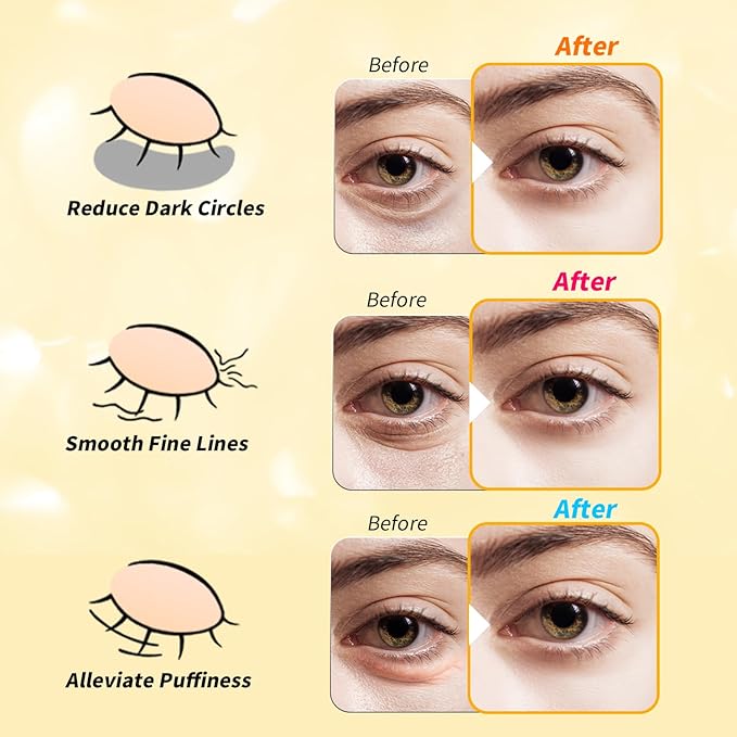 Under Eye Patches(36 Pairs), 24K Gold, Caffeine, Retinol Eye Masks for Puffy Eyes, Wrinkles, Dark Circles, Undereye Bags Treatment - Restoring & Awakening & Moisturizer Skin care Gift for Women