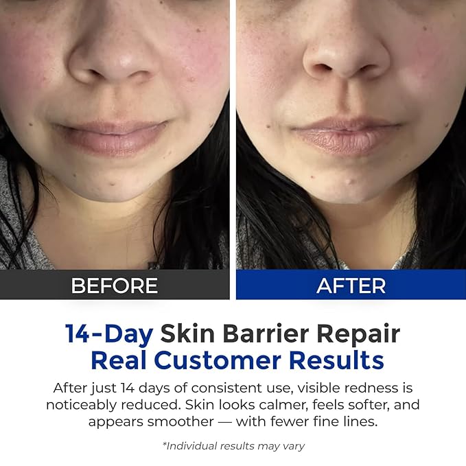 Intensive Repair Serum, 15%Hyaluronic Acid for Sensitive Skin Anti Aging Ultra Hydrating Serum for Face Calming Barrier Repair Redness Relief with Ceramides Centella 30Vials Daily Travel Care