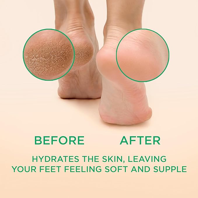 Lee Beauty Professional Callus Remover