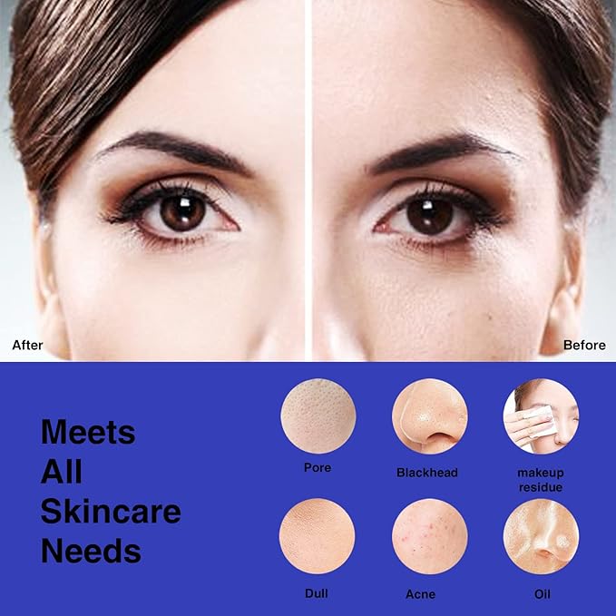 NågraCoola CLIE Facial Cleansing Brush, Waterproof and Rechargeable Face Scrub Brush for Men & Women, Cleansing, Exfoliating and Massaging, Electric Face Scrubber - Blue