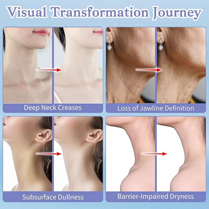 Neck Creams for Tightening and Firming - Anti Wrinkle & Treatment with Retinol Peptides, Ceramide - Overnight Moisturizer for All Skin Types - Sensitive Safe