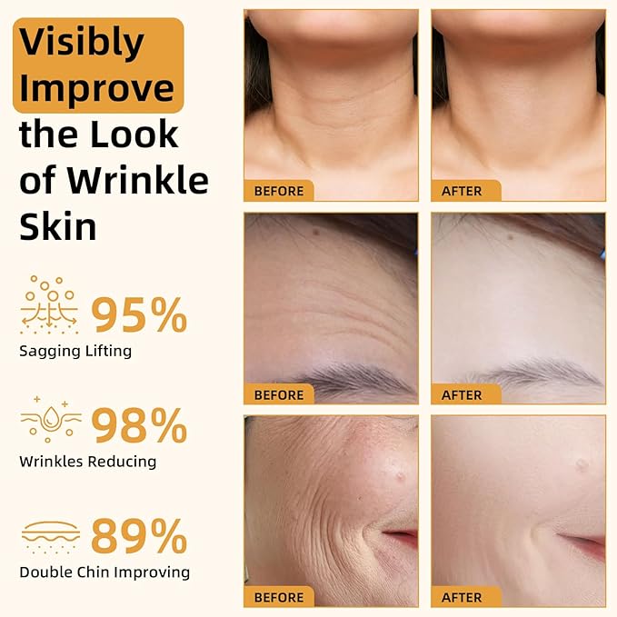 Bee Venom Firming Serum Stick, 2PCS Anti-Aging Face Cream, Lifts and Tightens the Skin, Hydrating, Lifting & Restoring Skin Elasticity, Bee Venom Body Tightening Cream for Women & Men