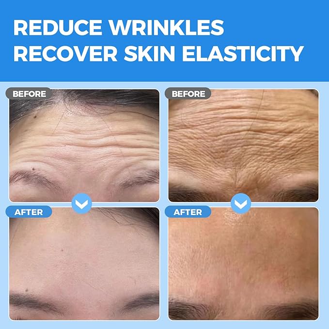 Okela Forehead Wrinkle Patches Overnight 20 pcs with Collagen, Anti Wrinkle Patches, Forehead Wrinkles Beauty Treatment