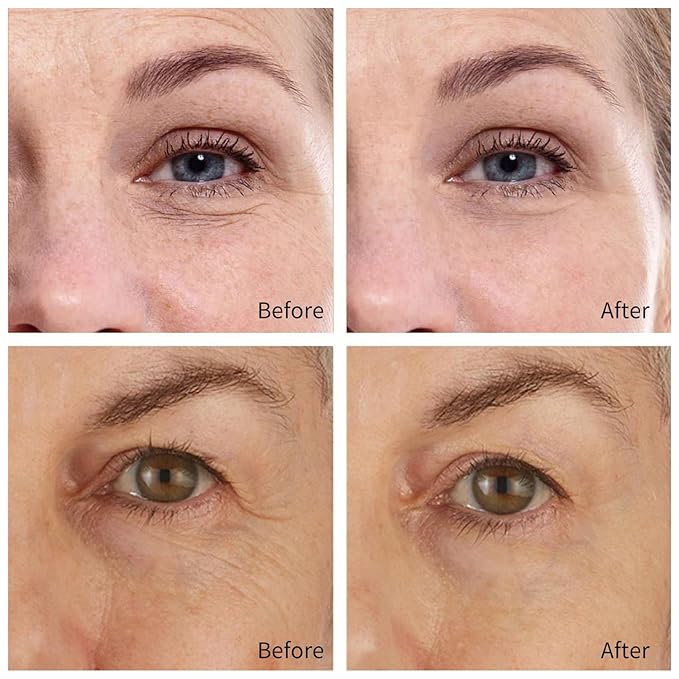 30 pairs retinol collagen eye