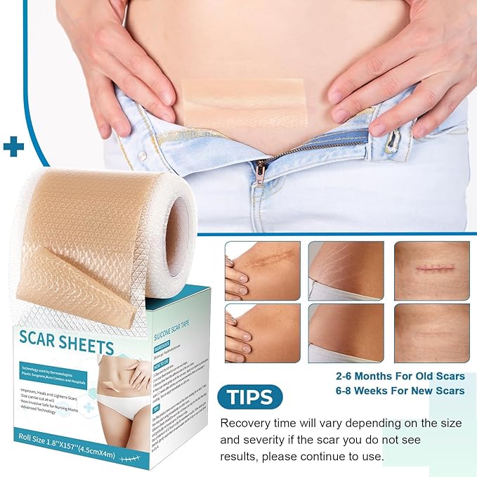 Silicone Scar Sheets, Silicone Scar Tape(1.8¡±x