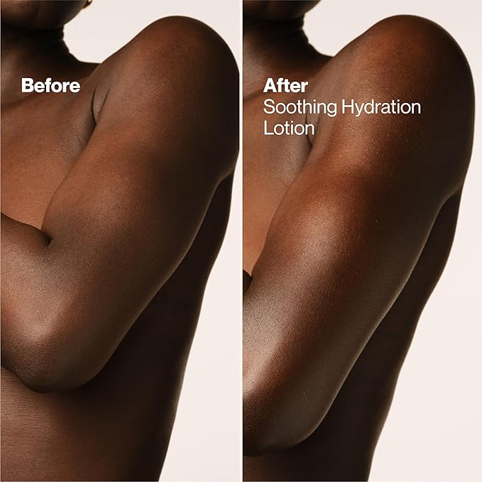 Suave Soothing Hydration Hand & Body Lotion With Aloe Vera Refreshes Dry Skin, Fast Absorbing, Intensive Moisturizing Cream For Women, Non Greasy, Allergen Free, 18 FL OZ, 6 Pack