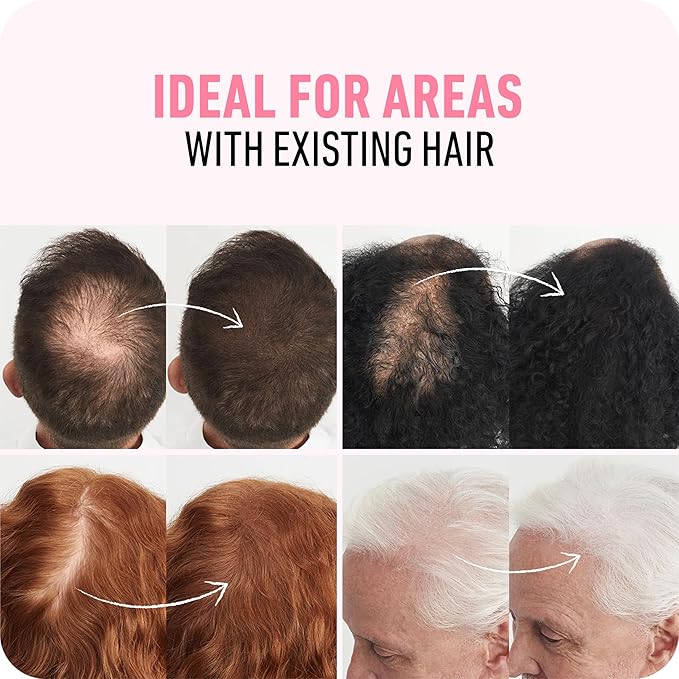 BOLDIFY Hair Fibers (12g) - Fill In Thinning and Fine Hair for an Instantly Fuller, Thicker Look - 14 Shades for Women & Men - White