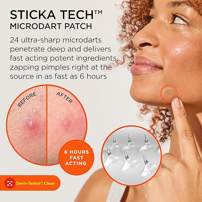 ZitSticka Killa Acne Patches for Face - World's Most Potent Pimple Patch with Fast-Acting Microdarts - Starts Working within 2 Hours for Deep, Early-Stage Zits - 20 Count