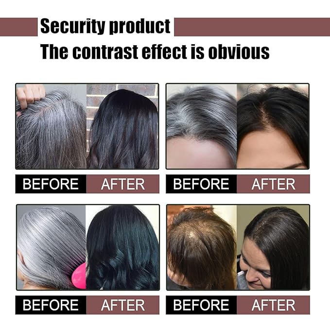 3PCS Hira Darkening Polygonum Shampoo Bar for Gray, Thinning Hair and Hair Growth (he shouwu) - Soap Bar