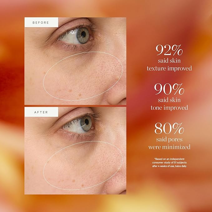 KORA Organics Turmeric Glow Drops, Niacinamide Alternative Face Serum for Radiance, Texture and Pore Appearance, Certified Organic, Vegan, 0.34 fl oz