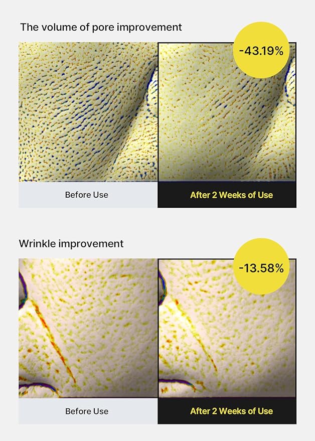 celimax The Vita A Retinol Shot Tightening Serum | with Pure Vitamin A Retinol, Peptide, Pore Minimizer, Wrinkles & Fine Lines, Firmer Skin, Anti-Aging, Skin Smoothing 30ml