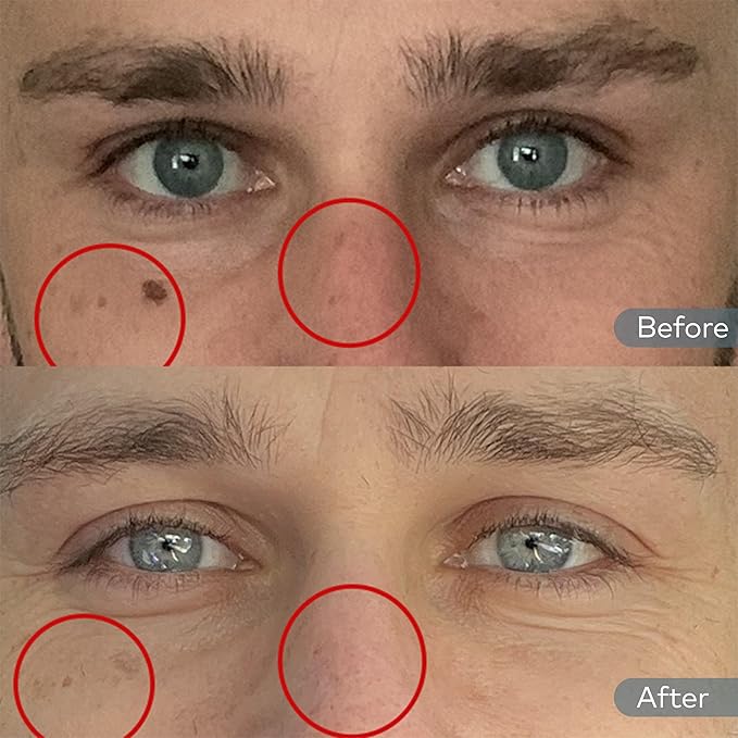 Onekind Dream Cream Night Moisturizer – Hydrating Anti-Aging Face Cream with Squalane, Rosehip & Shea Butter – Fragrance-Free, Vegan, for Dry & Sensitive Skin – 1.7 oz