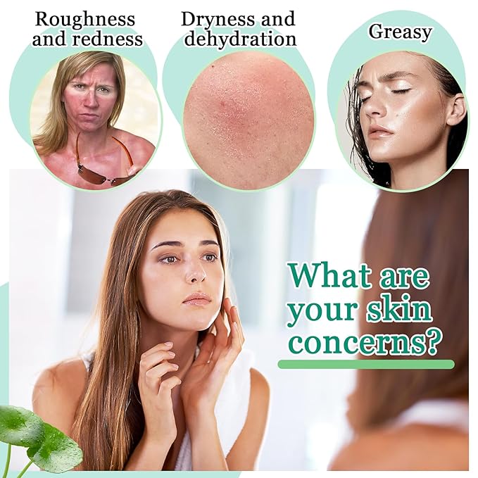 4PCS Aloe Vera Gel Moisturizer for Face,Hydrating Fast Absorbing Face Moisturizer After Sun Care,Moisturizing Long Lasting Non-Sticky Travel Size Aloe Vera Gel for Sunburn Relief