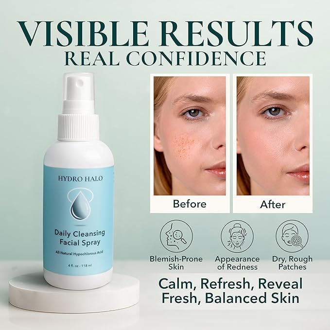 Hypochlorous Acid Spray for Face 4oz – Pure Hypochlorous Acid Spray Cleaner, Daily Cleansing Facial, pH Balanced, Plant Based, No Alcohol, USA Made