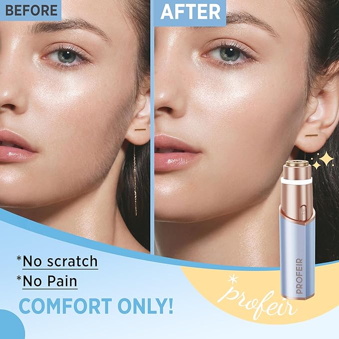 Facial Hair Removal for Women: Electric Hair Removal Device - Rechargeable Painless Face Razor for Chin Upper Lip Peach Fuzz with Light (Blue Gold)