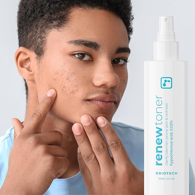 BRIOTECH Renew Toner, Hypochlorous Acid Spray, Minimize Appearance of Blemishes, Soothing Facial Mist for Sensitive Skin, Calm Redness & Bumps, Hypoallergenic & Vegan, 2 fl oz Travel Size (2)