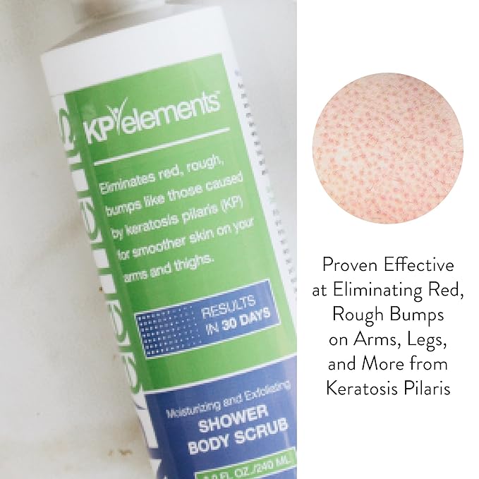 KP Elements Body Scrub (8 fl oz) | Keratosis Pilaris Treatment | Exfoliating Body Scrub and Body Moisturizer for Dry Skin | Helps Reduce Red Bumps | Body Skin Care Product for Men and Women
