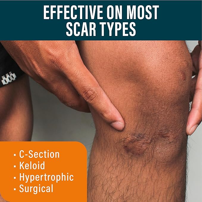 Scar Sheets Light Tone 4 Pack