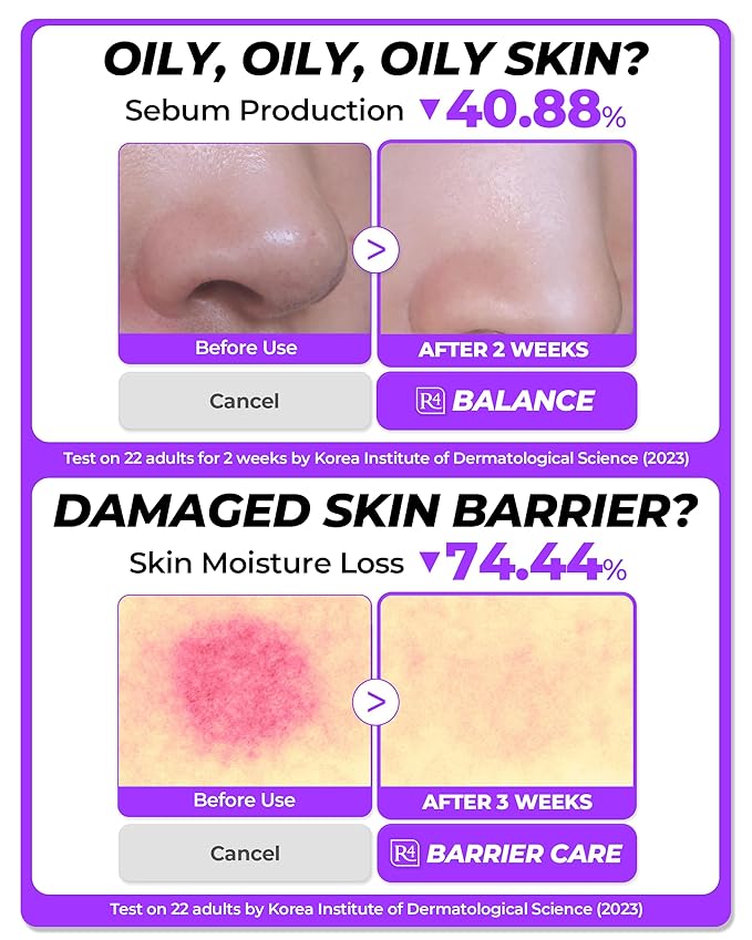 Soothing Repair Face Toner R4 | Hydrating Moisturizing fl oz