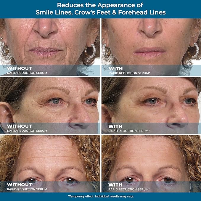 Plexaderm rapid reduction eye serum