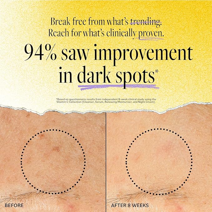 Derma E Vitamin C Cleanser - Daily Brightening & Hydrating Face Wash to Even Out Skin Tone – Moisturizing Face Cleanser for a Radiant Glow, 6 fl oz