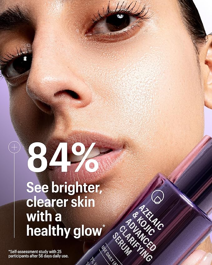 Allies of Skin Azelaic & Kojic Clarifying Face Serum | Clinically Proven for Acne & Blemish Prone Skin |10% Azelaic Acid Treats Pigmentation and Redness | Targets Pores & Uneven Skin Texture (1 Fl oz)