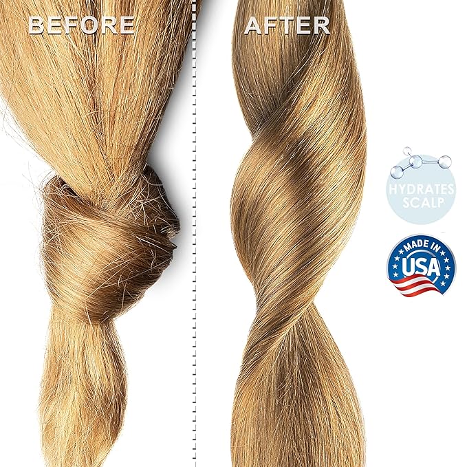 Soapeauty MEADOWFOAM SEED OIL Cold Pressed Unrefined | 100% Pure Natural Meadowfoam Seed Oil for Face & Hair | Moisturizer for Skin, Promotes Hair Growth, Balms | 4 fl oz