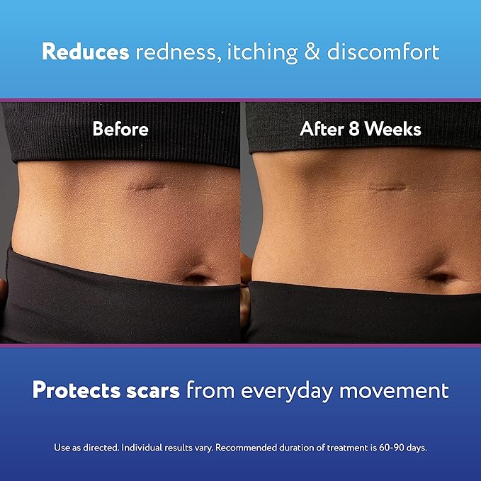 ScarAway Silicone Scar Gel, Helps Improve 10g